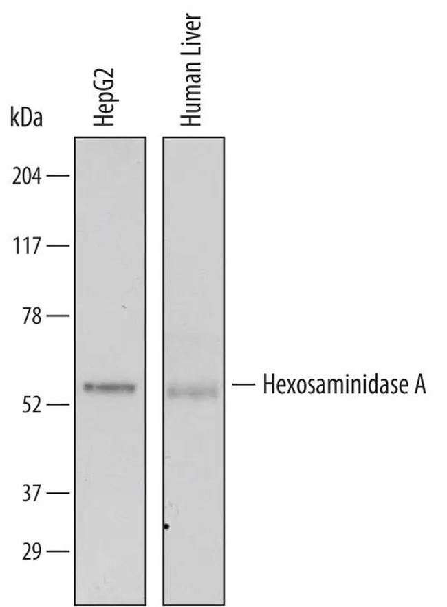 HEXA Antibody in Western Blot (WB)