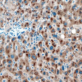 SULT1B1 Antibody in Immunohistochemistry (Paraffin) (IHC (P))