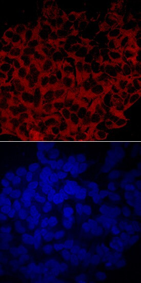 GBA3 Antibody in Immunocytochemistry (ICC/IF)