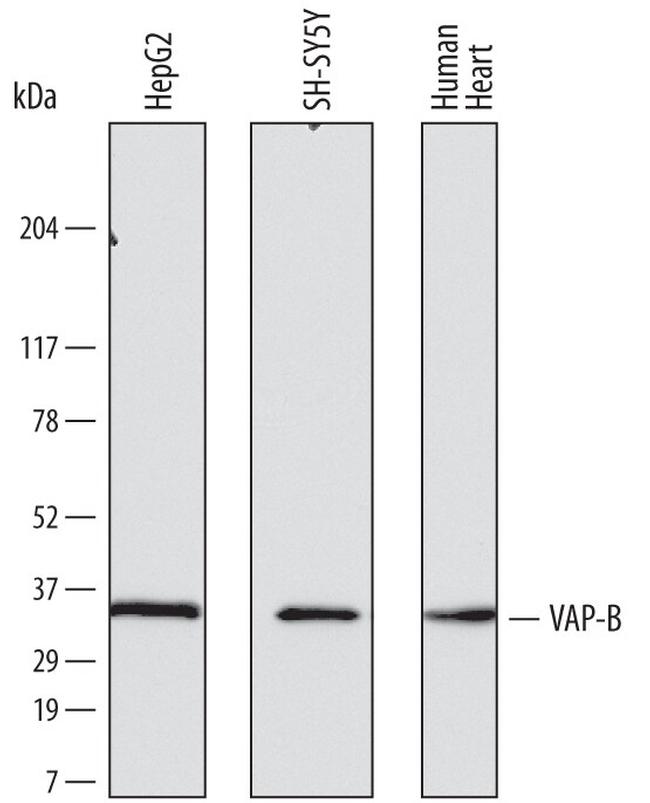 VAPB Antibody in Western Blot (WB)