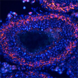 TDRD1 Antibody in Immunohistochemistry (Frozen) (IHC (F))