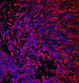 CRTAC1 Antibody in Immunocytochemistry (ICC/IF)