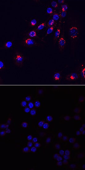 CCL3 Antibody in Immunocytochemistry (ICC/IF)