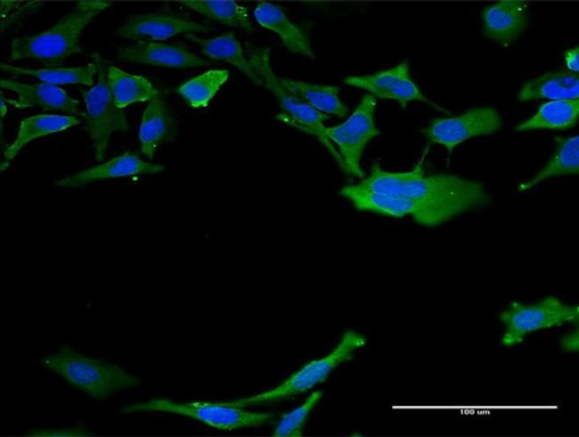 Calmodulin 3 Antibody in Immunocytochemistry (ICC/IF)