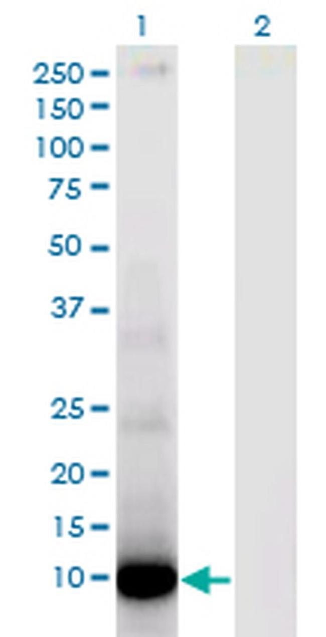 DEF6 Antibody in Western Blot (WB)