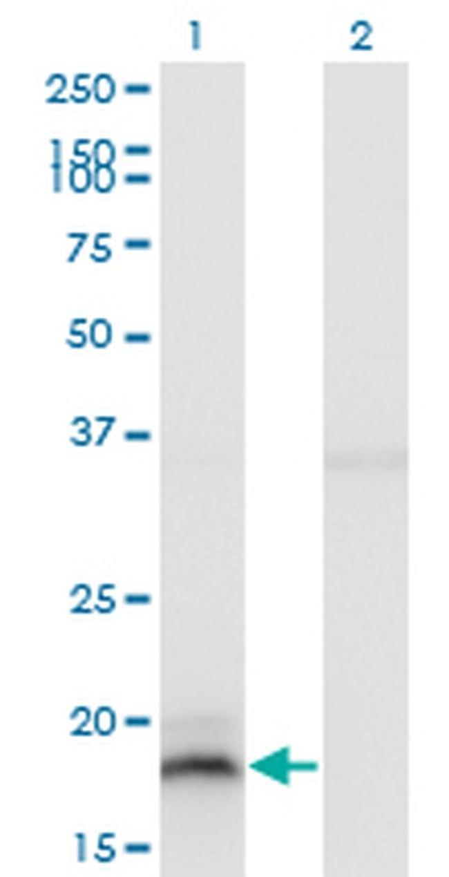 IFNA13 Antibody in Western Blot (WB)