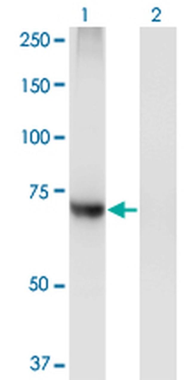 PIGQ Antibody in Western Blot (WB)