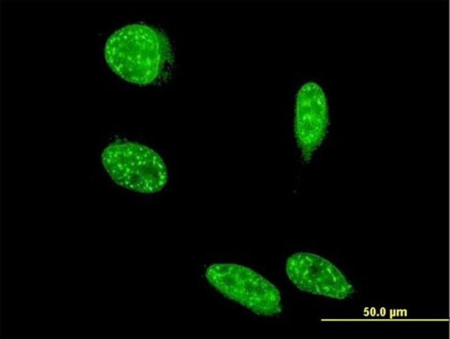 SAP18 Antibody in Immunocytochemistry (ICC/IF)