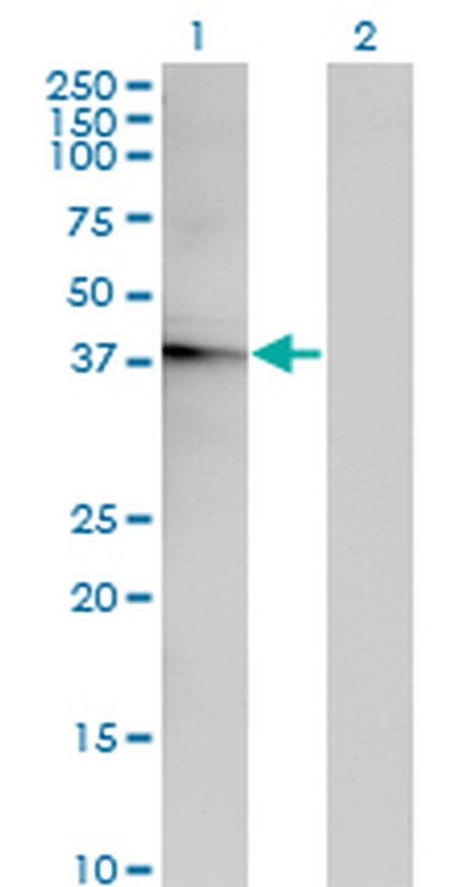 ACOT7 Antibody in Western Blot (WB)