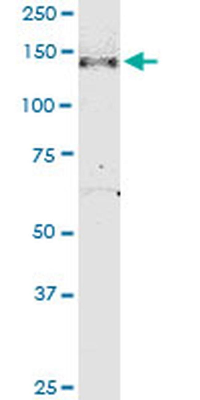 NPHP3 Antibody in Western Blot (WB)