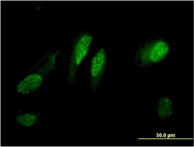 C13orf15 Antibody in Immunocytochemistry (ICC/IF)