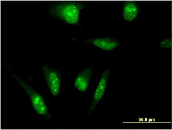 TAF7L Antibody in Immunocytochemistry (ICC/IF)