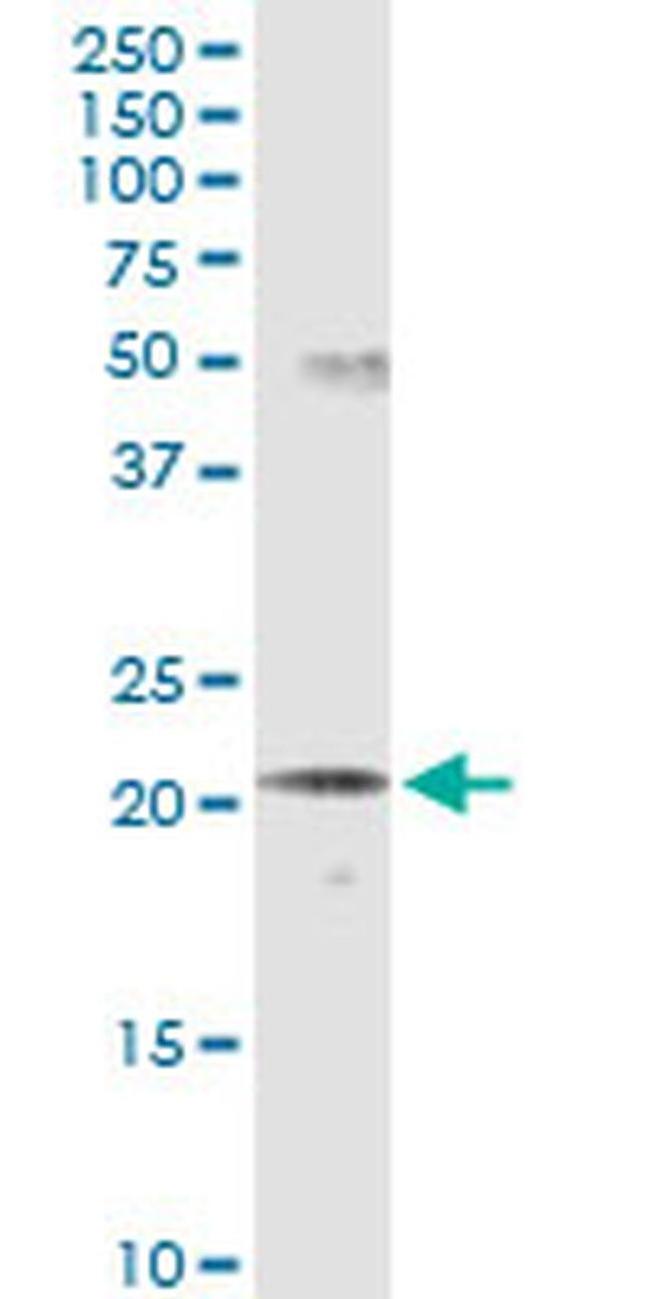 SCNM1 Antibody in Western Blot (WB)