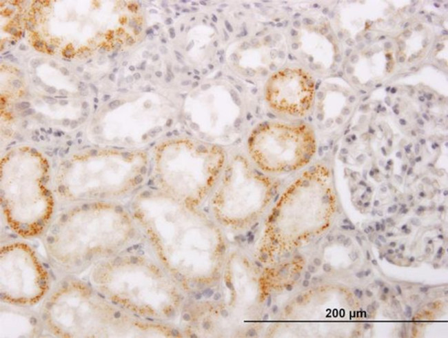 ACCS Antibody in Immunohistochemistry (Paraffin) (IHC (P))