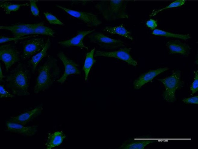 FMN1 Antibody in Immunocytochemistry (ICC/IF)