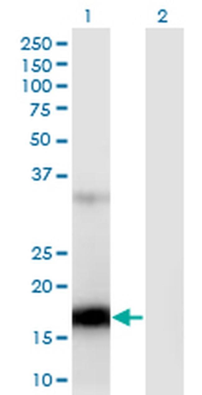 ZCCHC13 Antibody in Western Blot (WB)