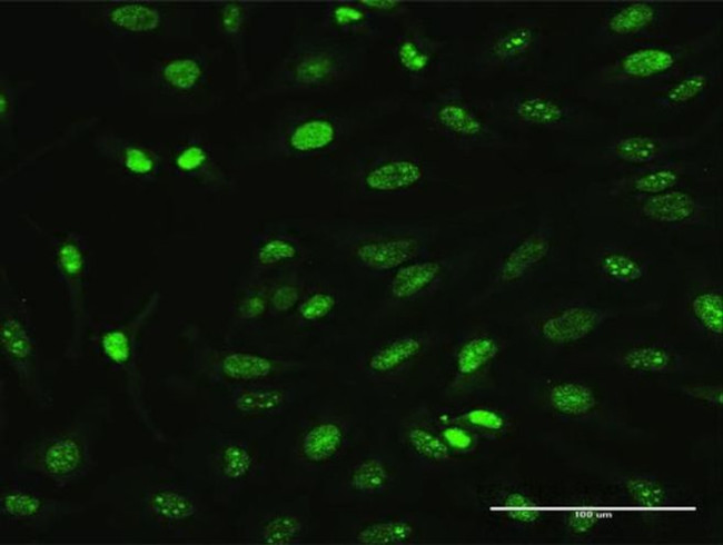 MAGEA2 Antibody in Immunocytochemistry (ICC/IF)