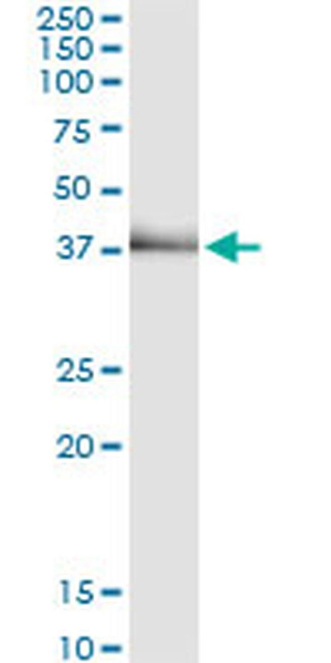 TRIB2 Antibody in Immunoprecipitation (IP)