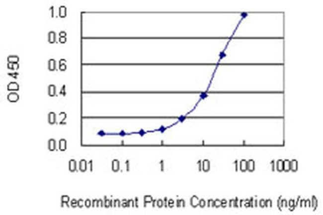 CSAD Antibody in ELISA (ELISA)