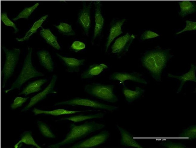 CSAD Antibody in Immunocytochemistry (ICC/IF)