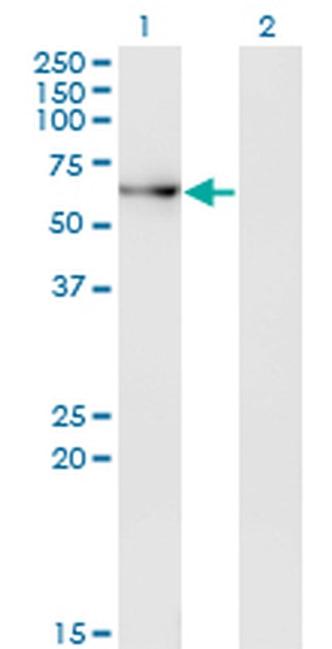 ACD Antibody in Western Blot (WB)