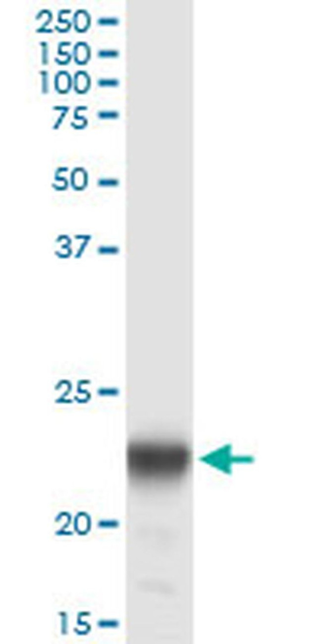 PMVK Antibody in Immunoprecipitation (IP)