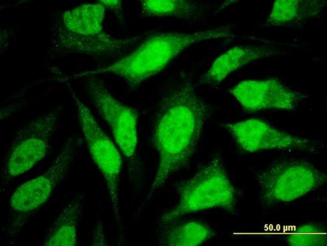 DCAF8 Antibody in Immunocytochemistry (ICC/IF)