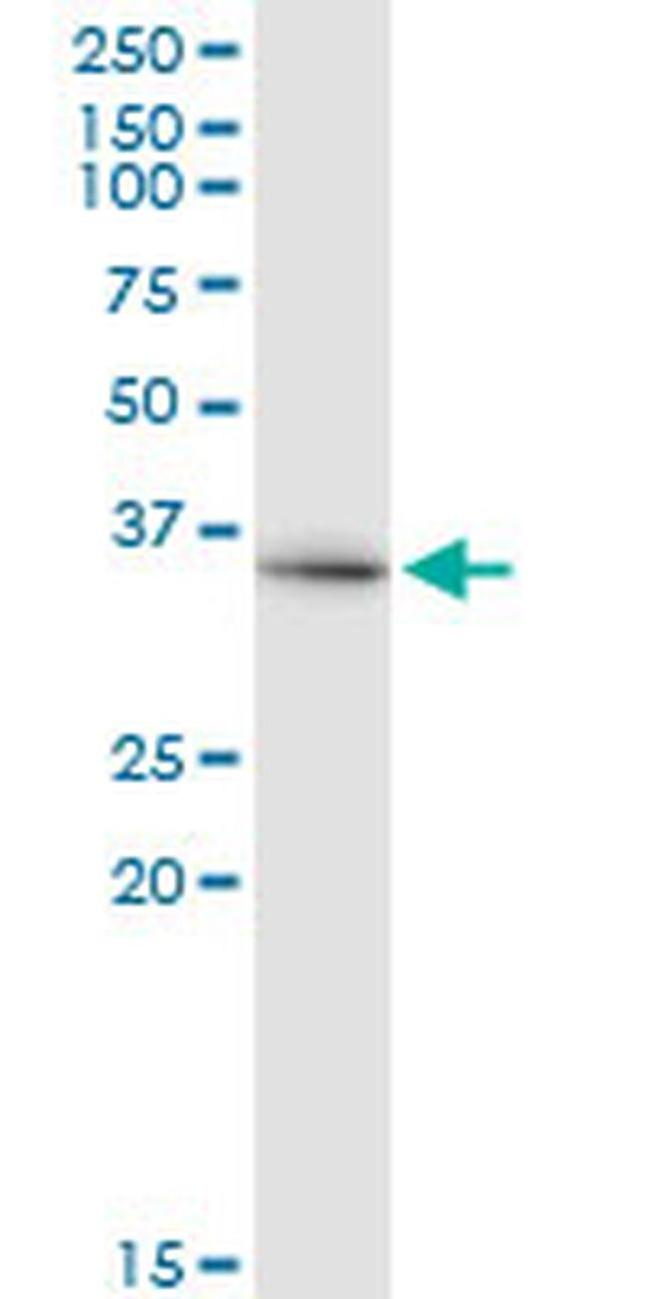 DCAF8 Antibody in Western Blot (WB)