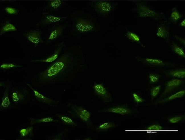 ZBTB25 Antibody in Immunocytochemistry (ICC/IF)