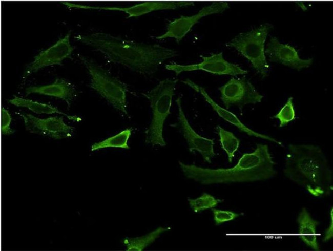 TSSK3 Antibody in Immunocytochemistry (ICC/IF)