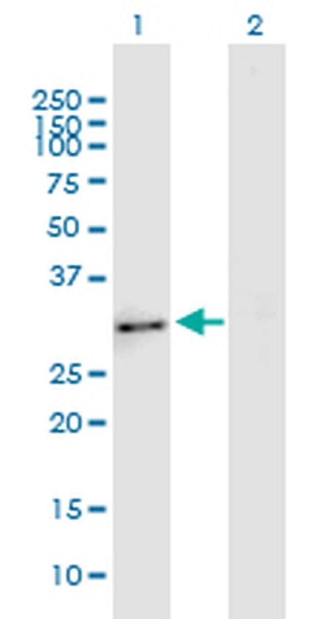 Enkurin Antibody in Western Blot (WB)