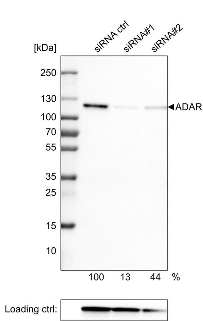 Adenosine Deaminase Antibody in Western Blot (WB)