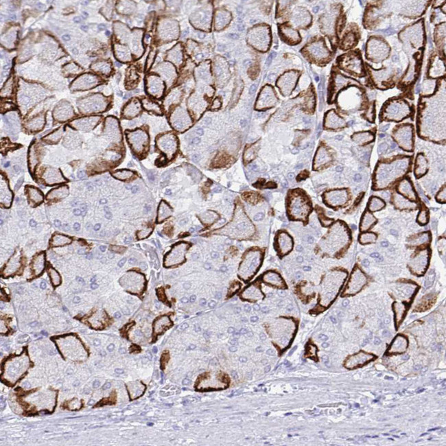 Aquaporin 4 Antibody in Immunohistochemistry (IHC)