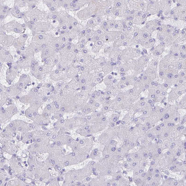 Aquaporin 4 Antibody in Immunohistochemistry (IHC)