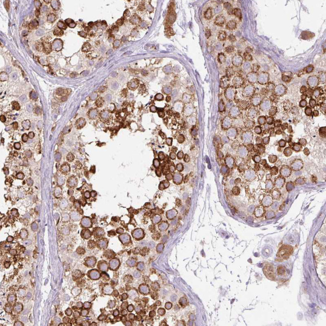 PCM1 Antibody in Immunohistochemistry (IHC)