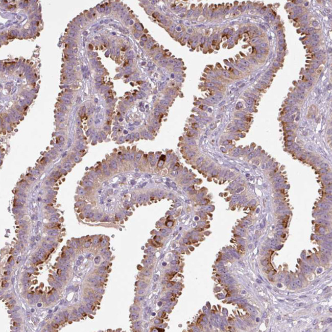 PCM1 Antibody in Immunohistochemistry (IHC)