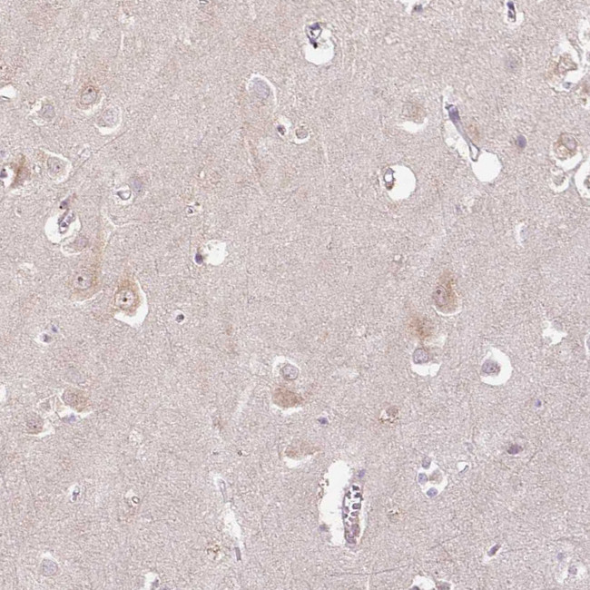 PCM1 Antibody in Immunohistochemistry (IHC)