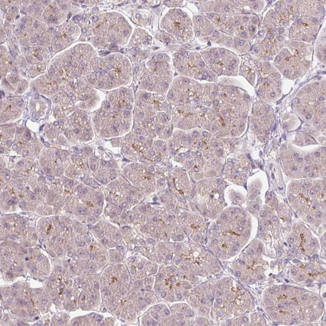 PCM1 Antibody in Immunohistochemistry (IHC)