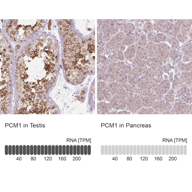 PCM1 Antibody