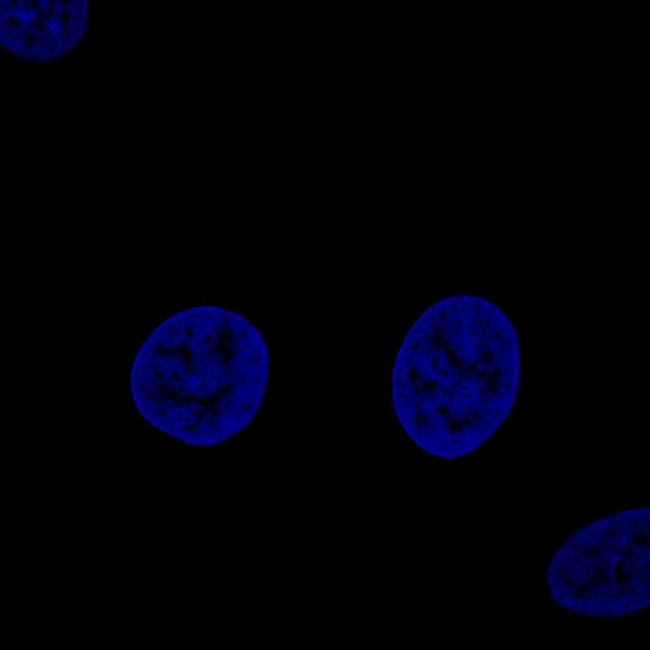 Fibulin 1 Antibody in Immunocytochemistry (ICC/IF)