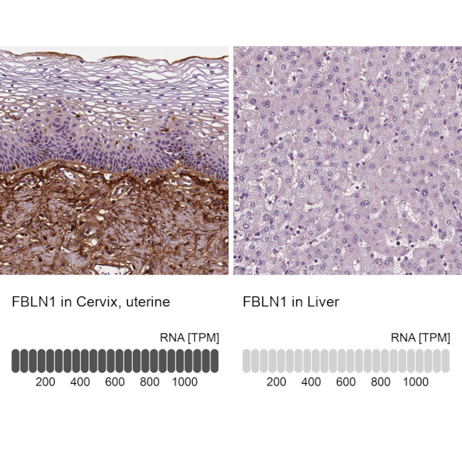 Fibulin 1 Antibody in Immunohistochemistry (IHC)