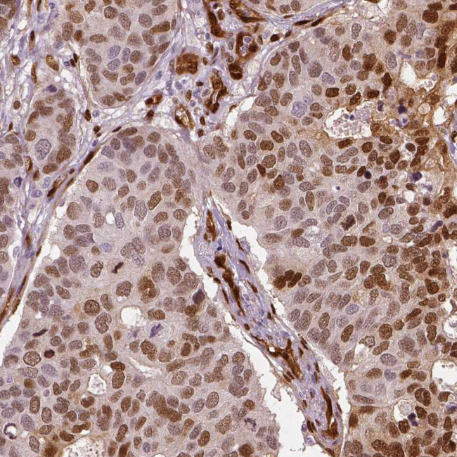 WWTR1 Antibody in Immunohistochemistry (IHC)