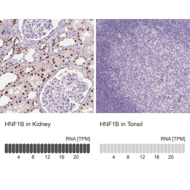 TCF2 Antibody in Immunohistochemistry (IHC)