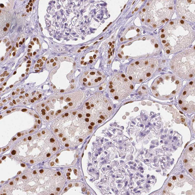 TCF2 Antibody in Immunohistochemistry (IHC)