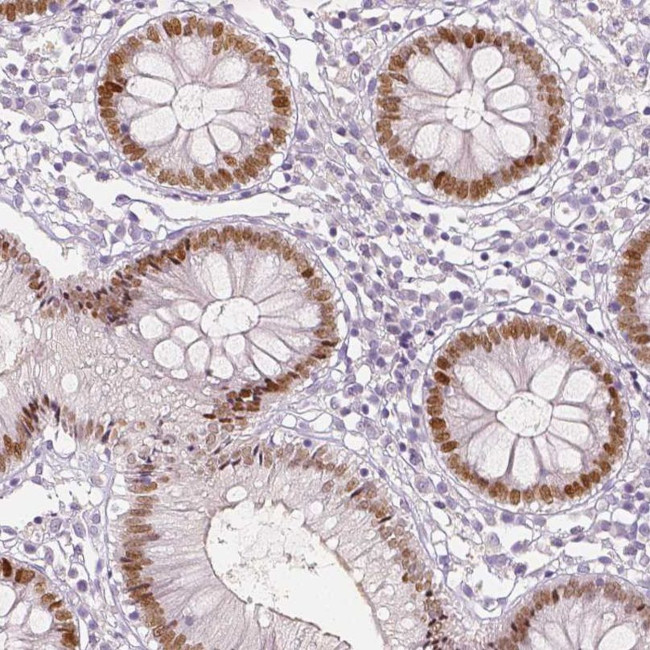 TCF2 Antibody in Immunohistochemistry (IHC)