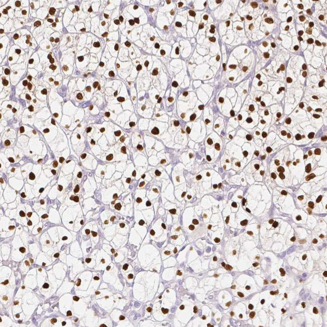 TCF2 Antibody in Immunohistochemistry (IHC)