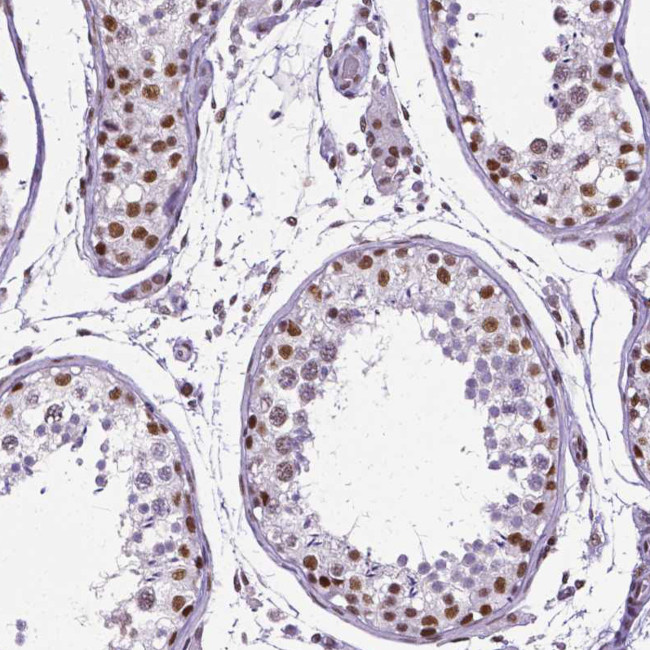 REST Antibody in Immunohistochemistry (IHC)