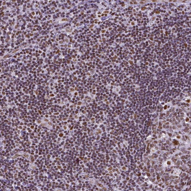 REST Antibody in Immunohistochemistry (IHC)