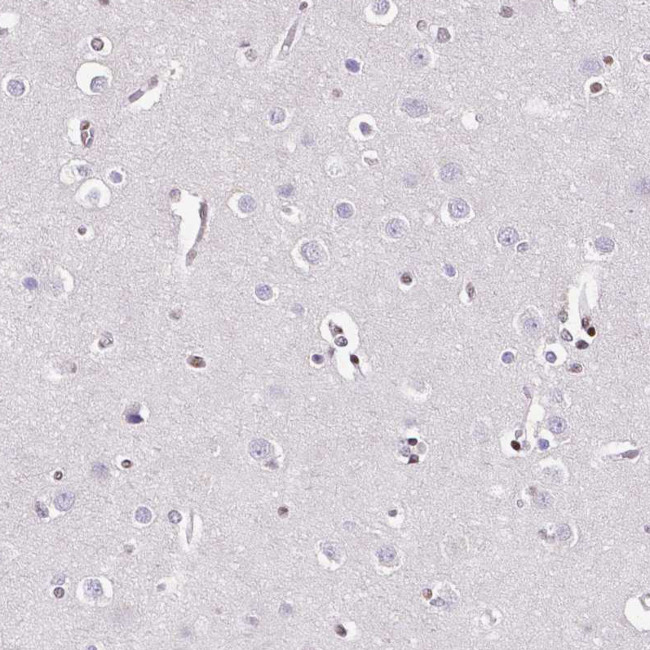 REST Antibody in Immunohistochemistry (IHC)