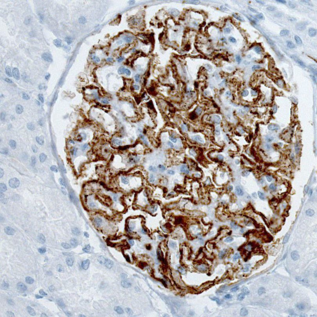 PLA2R1 Antibody in Immunohistochemistry (IHC)